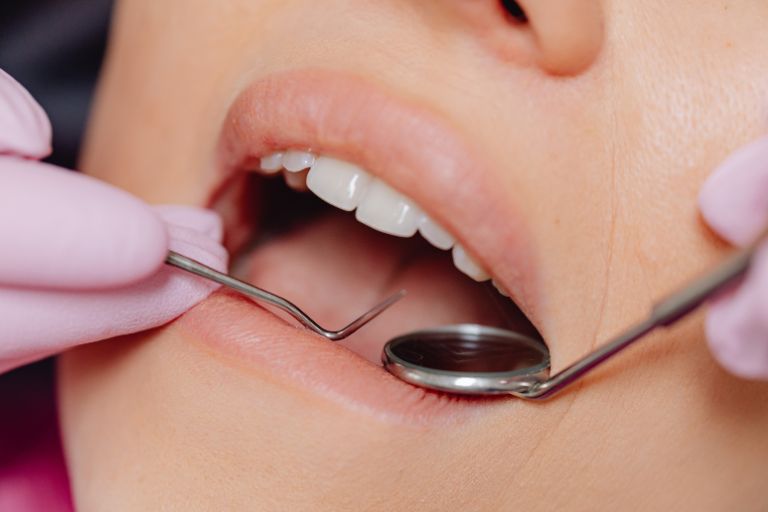 歯科医院で行うプロの口臭予防対策