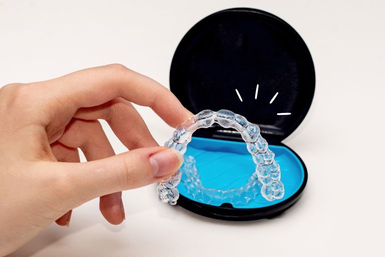 マウスピース矯正について