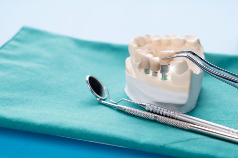 インプラントの適応症例