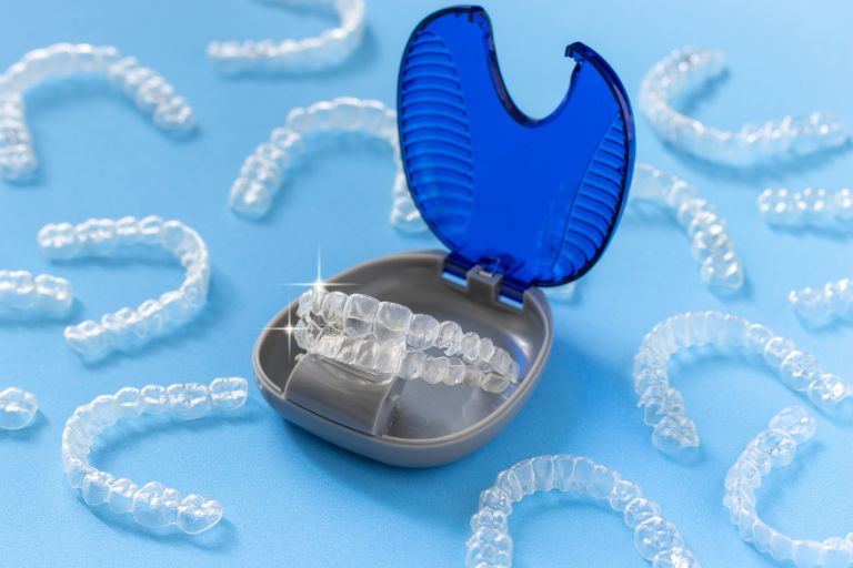 失敗・後悔を避けるためのチェックポイント