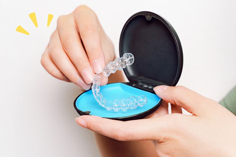 自分に合うマウスピースの選び方