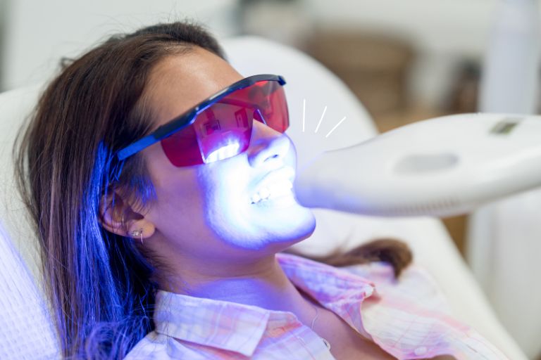 ホワイトニングにはどんな種類がある?