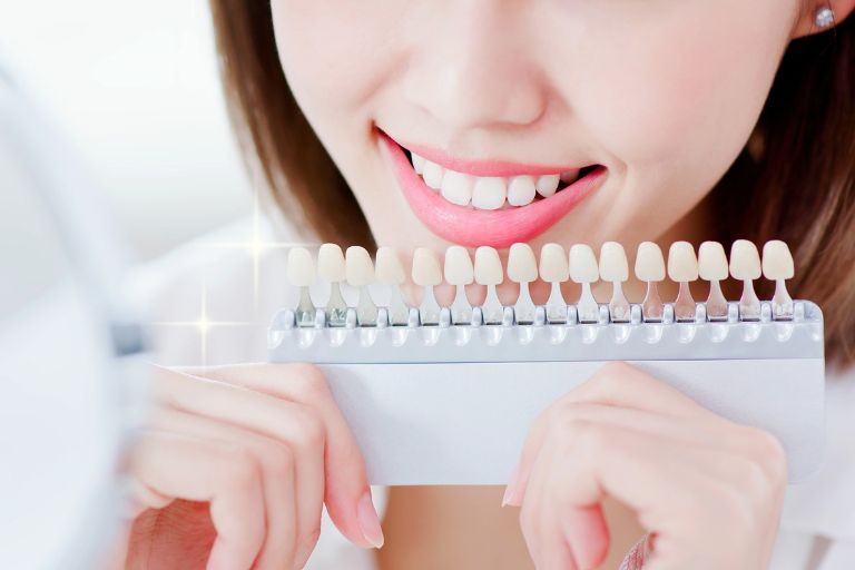 歯のホワイトニング