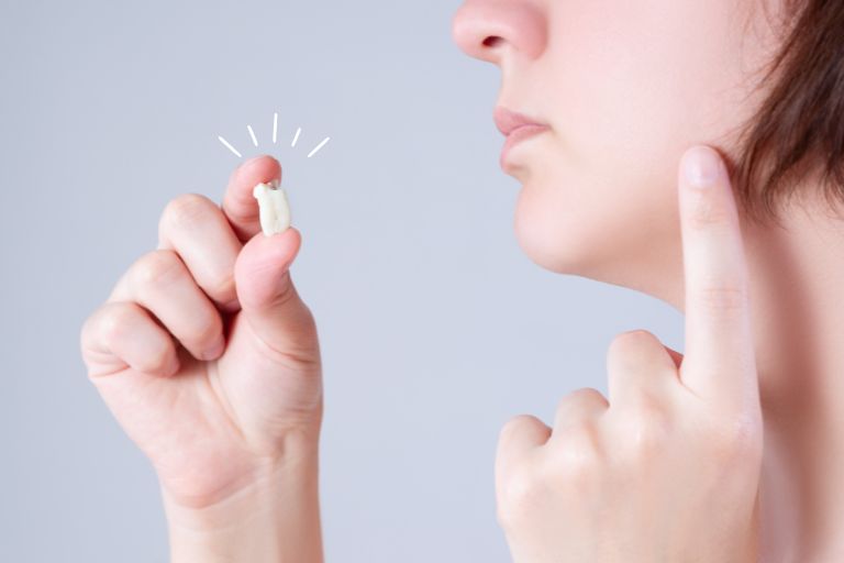 抜歯が必要になるケース