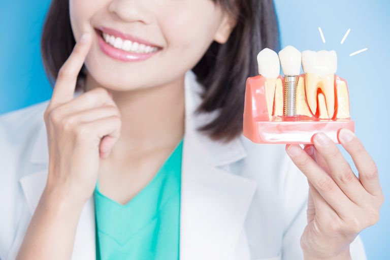 歯科インプラントとは?