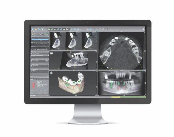 精密検査のイメージ