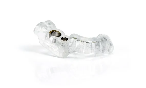 ガイデットサージェリー