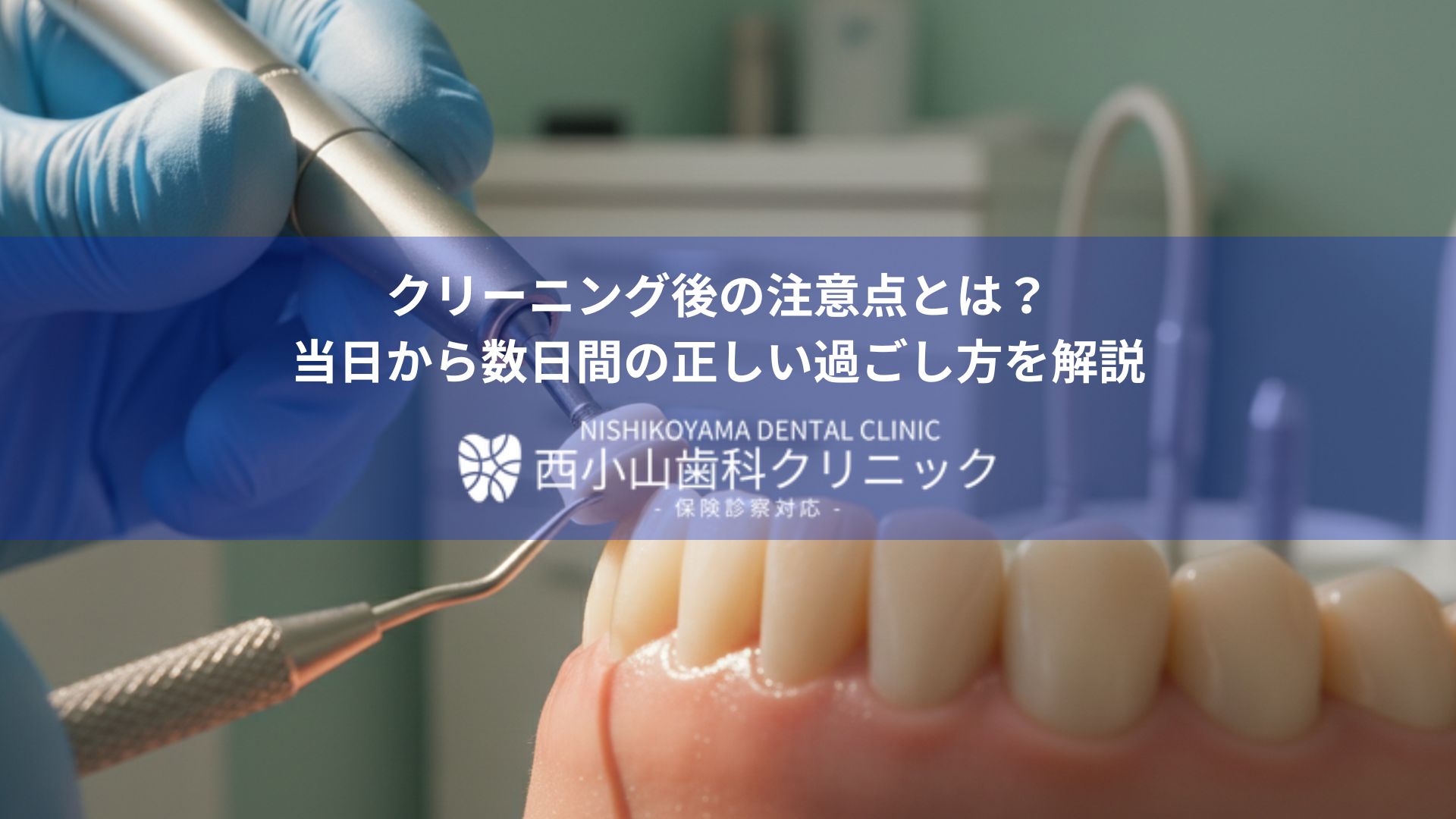 クリーニング後の注意点とは?当日から数日間の正しい過ごし方を解説